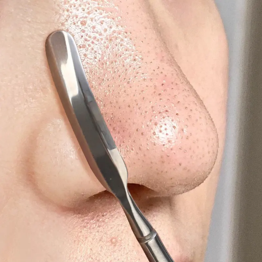 Espátula Removedora de Cravos Multiuso em Aço Inox | Extrator para Limpeza Facial e Cuidados com a Pele - Imagem 4